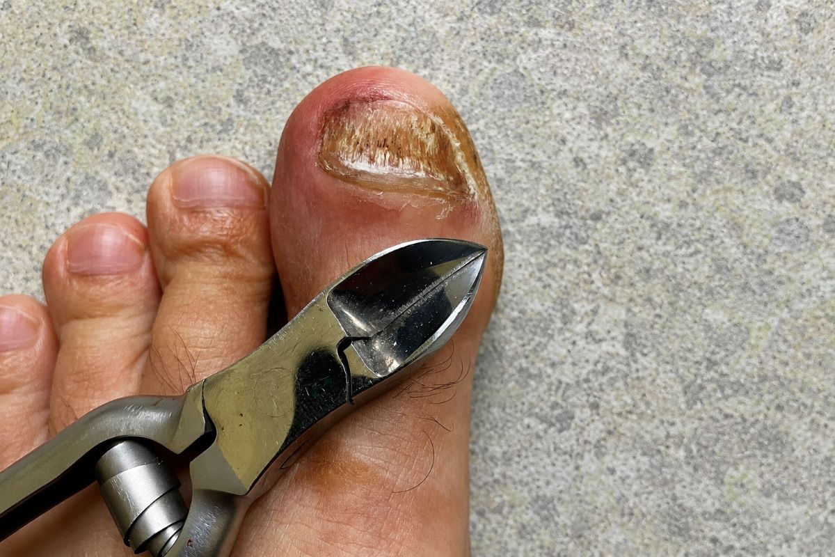 Nagelzange für dicke Fußnägel aus meiner Erfahrung