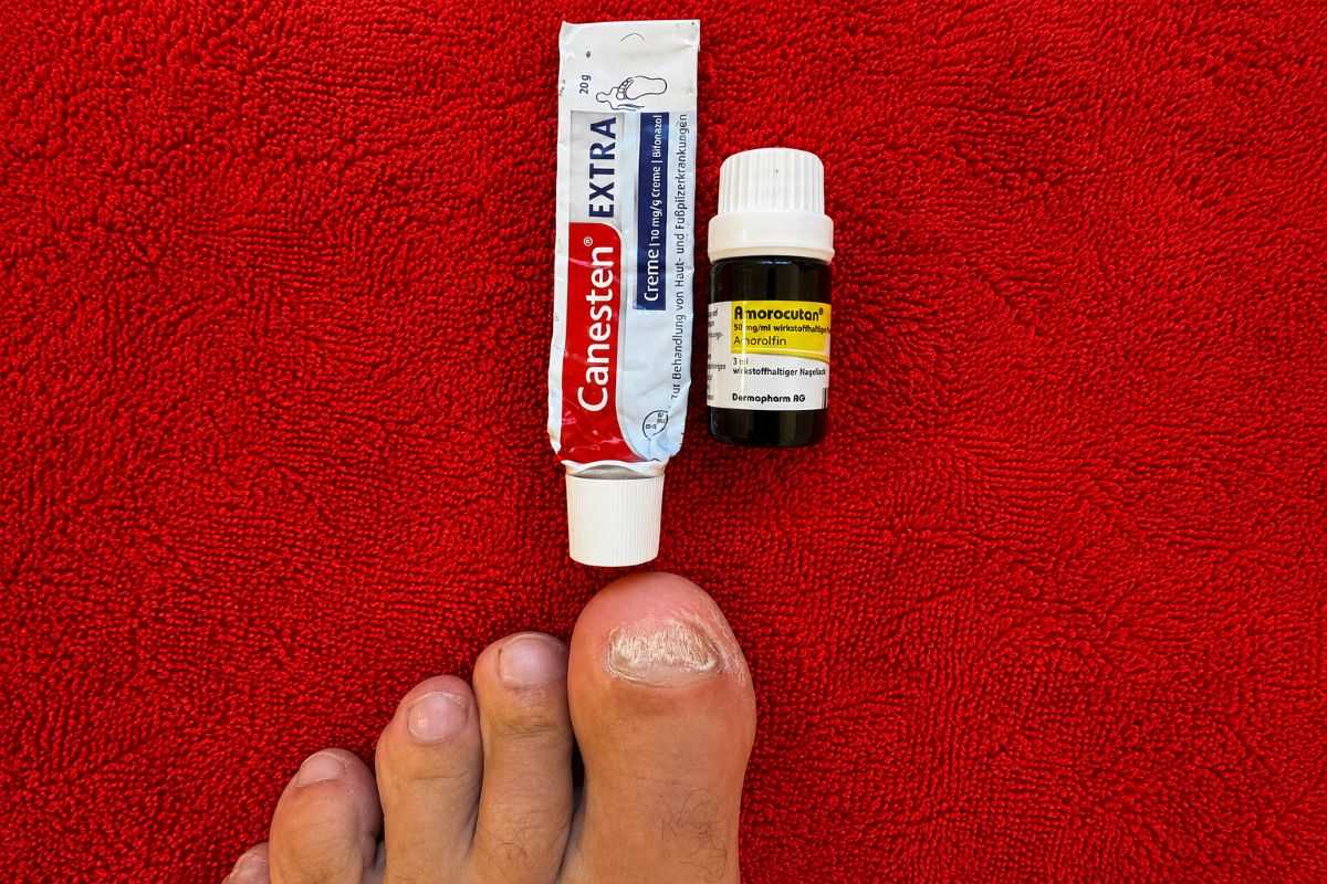 Canesten Extra Creme oder Amorolfin Nagellack bei Nagelpilz