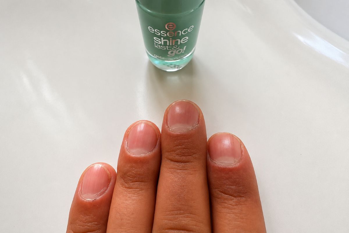 Grüner Nagel und mögliche Ursachen einer grünen Nagelverfärbung