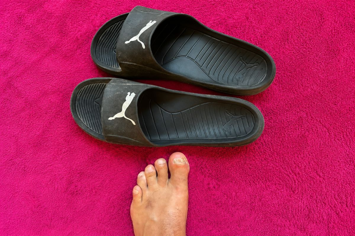 Mit Nagelpilz ins Schwimmbad mit Badeschlapfen