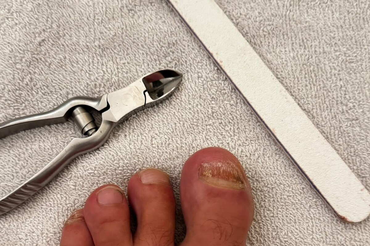 Nagelzange und weiße Feile neben einem Fuß auf einem Handtuch